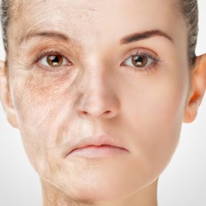肌が老化する糖化
