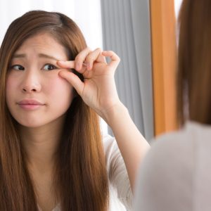 上まぶたのたるみ取り